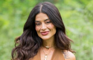 Aline Campos faz lifting facial após deixar o “BBB 26” e mostra resultado; veja antes e depois