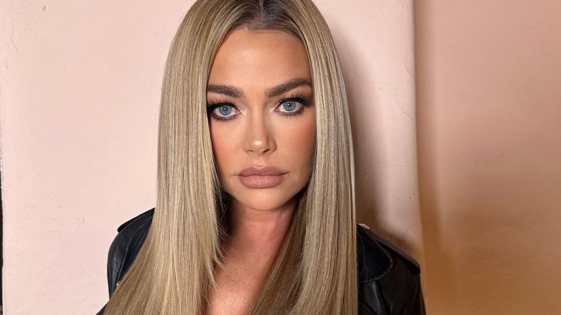 Ícone de beleza, Denise Richards mostra resultado de cirurgia plástica no rosto, e surpreende com antes e depois; confira