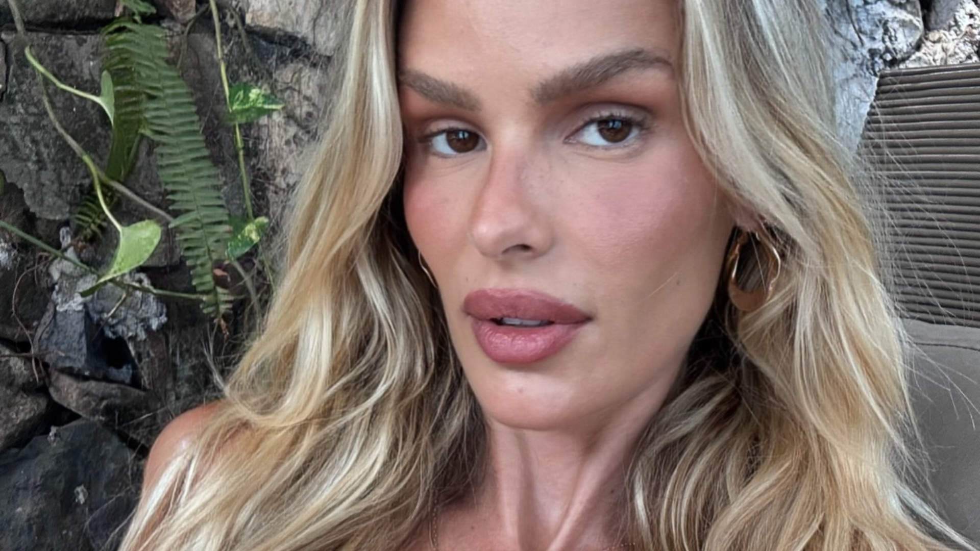 Yasmin Brunet mostra antes e depois após perder 25 kg com tratamento para lipedema; assista