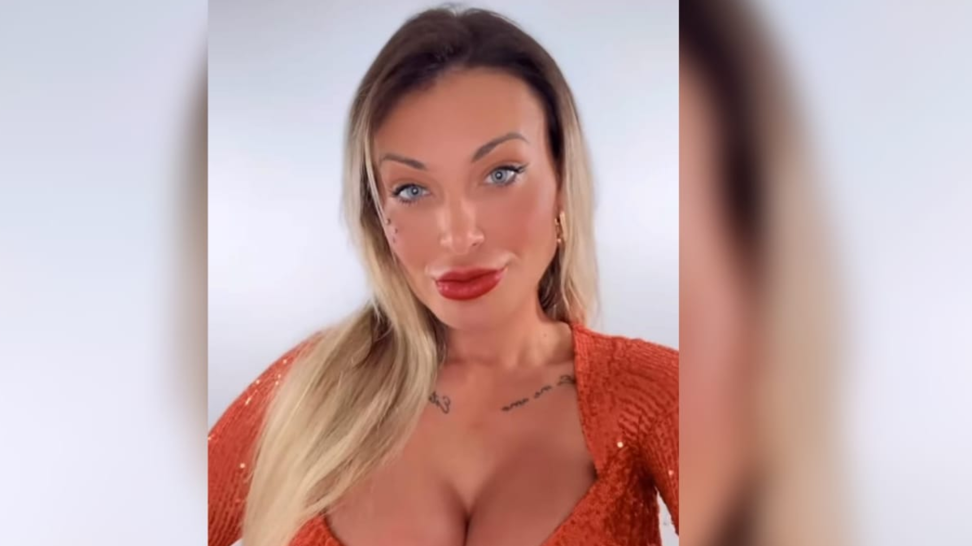 Andressa Urach exibe novo rosto após cirurgia plástica, diz que já fez 50 procedimentos e revela quanto gastou; assista